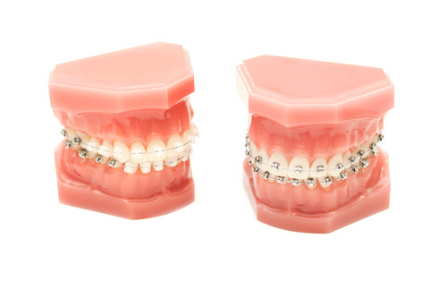 ortodontzia tratamendua